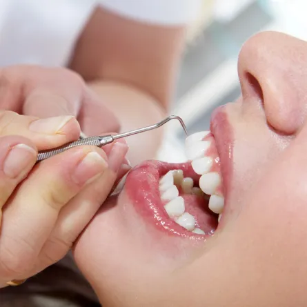 Smiling patient receiving a professional dental cleaning from a hygienist in a dental office.